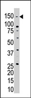 PAB4217 - USP28
