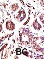 PAB4222 - UBE3A