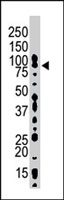 PAB4227 - HGS / HRS