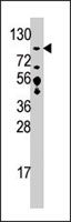 PAB4230 - USP33 / VDU1