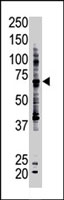 PAB4235 - Ubiquilin-1 (UBQLN1)