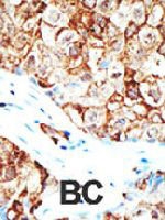 PAB4236 - Ubiquilin-1 (UBQLN1)