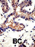 PAB4237 - Ubiquilin-3 (UBQLN3)