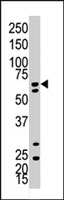 PAB4240 - Ubiquilin-3 (UBQLN3)