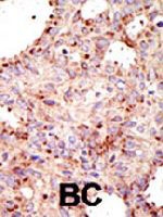 PAB4255 - ARFGAP1