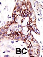 PAB4262 - ARL3