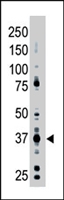 PAB4271 - CD296 / ART1