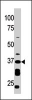 PAB4272 - CD296 / ART1