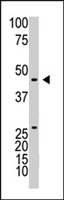 PAB4274 - ART3 / TMART