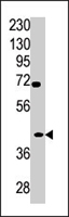 PAB4294 - TPST2