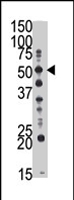 PAB4301 - GCNT1 / NACGT2
