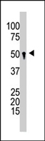 PAB4302 - GCNT1 / NACGT2