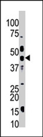PAB4304 - MGAT1