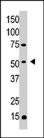 PAB4305 - MGAT1