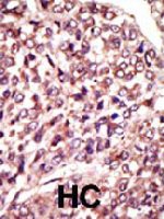 PAB4305 - MGAT1