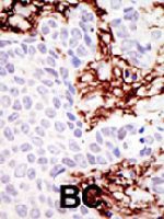 PAB4307 - MGAT2