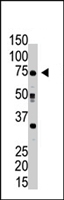 PAB4310 - Ribophorin-1 / RPN1