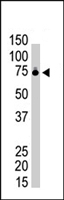 PAB4310 - Ribophorin-1 / RPN1
