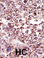 PAB4311 - Ribophorin-2 / RPN2