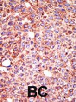 PAB4313 - MGAT3