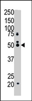 PAB4320 - Squalene synthetase