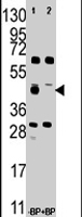 PAB4321 - Squalene synthetase
