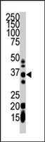 PAB4325 - GGPP synthetase