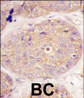 PAB4325 - GGPP synthetase