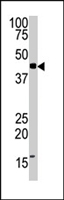 PAB4326 - FNTA