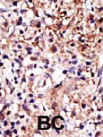 PAB4337 - Caprin-1