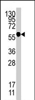 PAB4339 - Heat shock factor 1 / HSF1