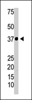 PAB4345 - NFKBIA / IKBA