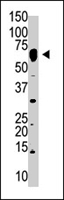 PAB4349 - NUB1