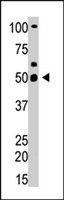PAB4360 - YY1