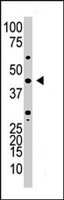PAB4361 - YY1