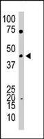 PAB4361 - YY1