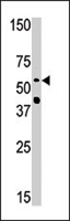 PAB4364 - NMT2