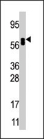 PAB4367 - ACOX1