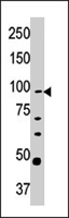PAB4370 - CPT1A / CPT1-L