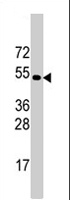 PAB4372 - TRIM69 / RNF36