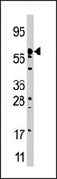 PAB4373 - CPT2