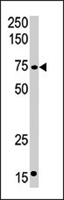 PAB4374 - CPT2