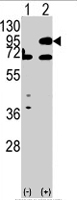 PAB4375 - CPT1B / CPT1-M