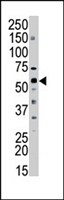 PAB4377 - SPTLC2