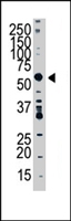 PAB4378 - SPTLC1