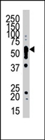 PAB4378 - SPTLC1