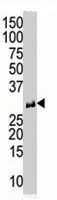 PAB4385 - Calcipressin-1