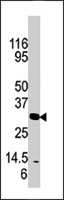 PAB4401 - Kallikrein-3 / PSA / KLK3