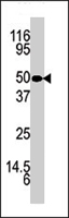 PAB4411 - KLK5 / Kallikrein-5