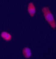 PAB4436 - Glypican-3 / GPC3